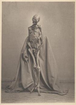 Photograph of found bog body of 1873. The body had been found in 1871 in the Heidmoor near de:Rendswühren and is now on display at Gottorf Castle, Schleswig Germany. Dated around 1st or 2nd century AD