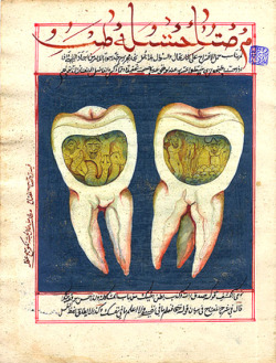 18th C. Turkish dental book. Beware of devils in your teeth.