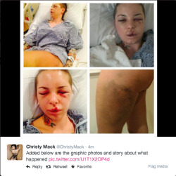housewifeswag:  Christy Mack released the statement above on her Twitter today about the abuse she endured Friday by the hands of her boyfriend, MMA fighter, Jon Koppenhaver. She said this isn’t the first time it’s happened but it’s the never been