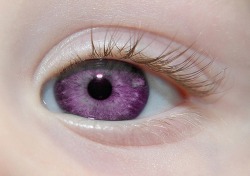 Alexandria’s Genesis, also known as ”violet eyes” (a mutation). &ndash; a hoaxWhen someone is born with Alexandria’s Genesis, his eyes are blue or gray at birth.After six months, the eyes begin to change their original color to