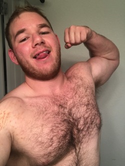 dylanprogress: Had some massage done a few days ago and it left some pretty gnarly marks on my bicep and shoulder. Should go away in a few days. My arms and pecs are feeling much better since the work, though, so that’s great. Hope everyone has a great