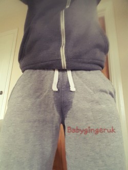 babygingeruk:So daddy is away to work. I took my nappy off and put big boy pants on. I guess there are no breaks with a catheter. Just a constant drip. 