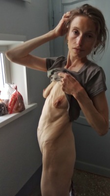 maturesabine: Very skinny mature female showing her very natural and sexy body. What an intimate and hot photo, enormous big areola and saggy soft udders. You’re wonderful and nothing to shame for. Enjoy your nudity and share your horny body with us.
