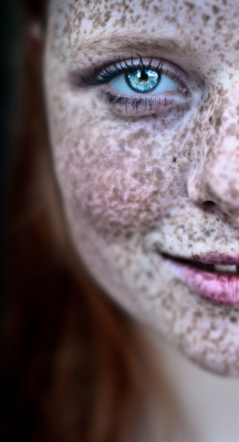 groteleur:  More girls with freckles &gt;