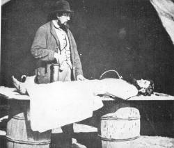 prosthodontia:  Dr. Burr at his infamous embalming tent during the Civil War, c. 1861.  