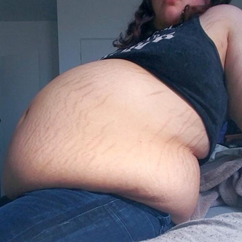 neptitudeplus:  She isn’t just a babe with a belly – she’s a walking beer-keg made of flab!