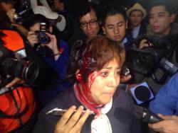 dynastylnoire:  laos-dothedu:  #SOS1DMX DEAR FOLLOWERS  This is happening Right NOW in Mexico City, we need your help again to make this images travel around the globe, Police in Mex is attacking the peaceful protesters and hitting inocent people, the