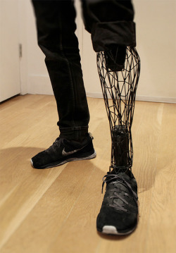 stunningpicture:Badass 3d printed titanium prosthetic leg