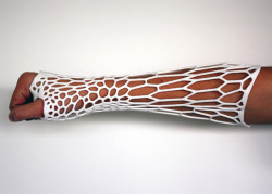 fuckyeahmedicalstuff:  3D-printed, recyclable ‘Cortex’ cast, by Jake Evill.After many centuries of splints and  cumbersome plaster casts that have been the itchy and smelly bane of millions of children, adults and the aged alike, the world over,