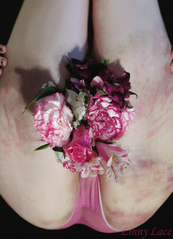 linnylace:Late Valentine’s Day post: this is easily becoming one of my favorite bruise-related photosets. The flowers were picked out specifically with my bruise colors in mind ♡  