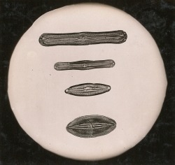 dame-de-pique:  Arno Vater, 1931  Navicula  Cestoda’s head  Siliceous sponge  Snail’s radula 