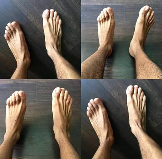 dedos de pies