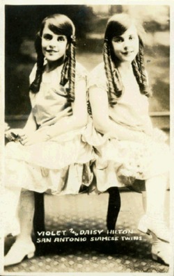 Violet and Daisy Hilton, San Antonio Siamese Twins.