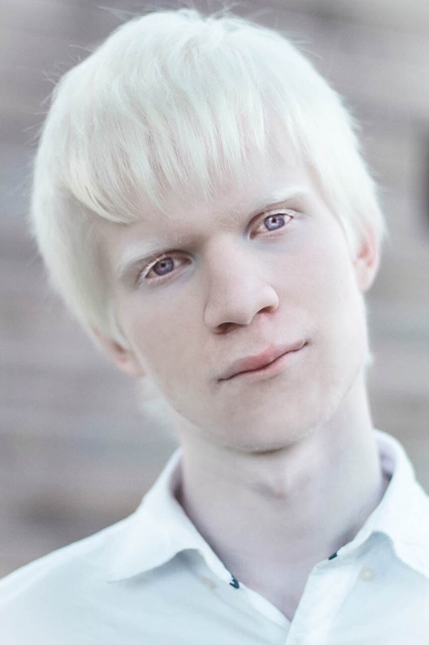 Albino White Teen 69