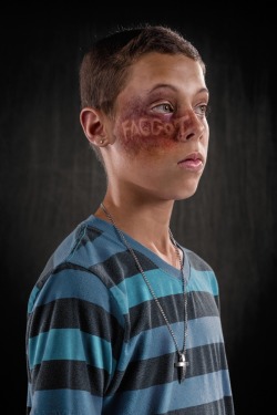 the-promised-wlan:  tonytobar:  What if verbal abuse left the same scars as physical abuse? Would it be taken more seriously? That’s what photographer Richard Johnson hopes to accomplish with his new photo project, “Weapons of Choice.” The series