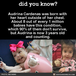 did-you-kno:  Audrina Cardenas was born with her heart outside of her chest. About 8 out of every 1 million babies have this condition, which 90% of them don’t survive, but Audrina is now 3 years old and counting. Immediately after birth, doctors were