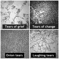 These are pictures of different dried human tears. Grief, laughter, onion and change. Each type has a different chemical makeup which makes them appear different.