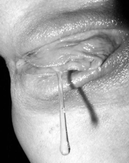 Long xxx Still nervous about this 5, Mom xxx picture on cumnose.nakedgirlfuck.com