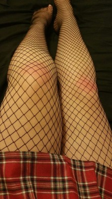 cuckingcherry:  You know it was some damn good sex when your knees look like this  Hahaha nice