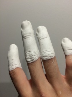 marcgiela:  lmao i put plaster on my fingers 