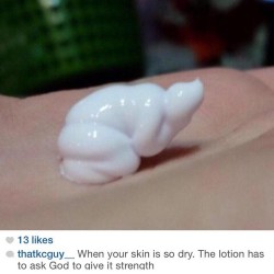 niggaimdeadass:  How my eczema cream be looking