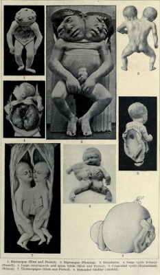 Examples of the some of the various deformations of the fetus known to cause dystocia