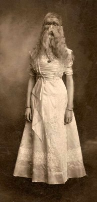 Alice Elizabeth Doherty (1887-1933) Alice E. Doherty was born in 1887 with a rare genetic mutation called &ldquo;hypertrichosis&rdquo;, or &ldquo;werewolf syndrome&rdquo;, which causes excessive body hair. She was billed as &ldquo;The Minnesota Woolly