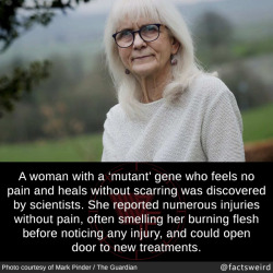 mindblowingfactz:  A woman with a ‘mutant’ gene who feels no pain and heals without scarring was discovered by scientists. She reported numerous injuries without pain, often smelling her burning flesh before noticing any injury, and could open door