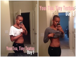 alexandraelle:  So I am officially done with my YourTea detox. My bloating has gone down tremendously and my BMs are more regular than they were. I don’t attribute the total decrease in bloating to the tea though. While it did help, a lot, I also did