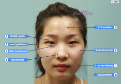 New Post has been published on http://bonafidepanda.com/plastic-surgery-korea/Plastic Surgery in Korea It’s amazing to know that in this lifetime we are now able to alter anything on our face and body by going through cosmetic surgery. There’s just