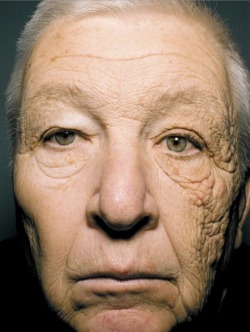 &ldquo;This guy is a truck driver, 69 years old, who&rsquo;s been exposed to 25 years of direct sunlight thanks to his job&ndash;but only on the left side of his face. So we get a first-hand view at how much more aged human skin looks when bombarded with