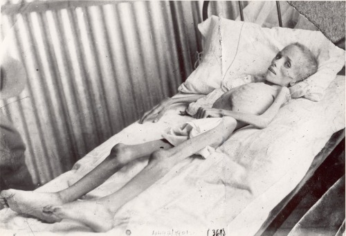 Nazi medical experiments on children