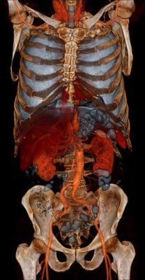 scienceyoucanlove:  It’s a work of art, but it’s not Photoshopped. Using volume rendering of computerised tomography (CT) scans, researchers can visualise shading and shadows to reveal the shape of internal organs and the structure of the bones.See