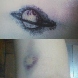 murderyourjoy:  This is a bruise. I made Saturn out of it. 