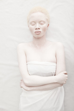 2dots:   Justin Dingwall : Albus Albus, a beautiful photography series that explores the aesthetics of Albinism in contrast with the idealized perception of beauty. Thando Hopa, the model is a South African legal prosecutor and now fashion model, uses