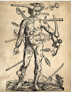 allegedlyobscure:(Vintage Anatomy Reproduction Print) Wounded Man/ Antique Weapons 