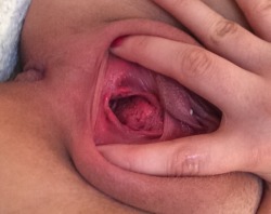 ilovebigthings69:  fistmesenpai:  ilovebigthings69:  fistmesenpai:  My gape afterwards  This is what you called a well stretched sore sloppy loose busted little cunt hole, when you have nothing better to do but to degrade your poor little pussy and make