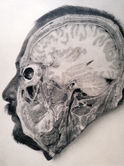 &ldquo;Dissecting the criminal brain. This 1904 photograph by Argentinian physician Dr. F. Perez shows a section of an executed criminal&rsquo;s brain. Unfortunately, his work merited little results - he found no major differences between the brains of