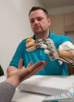 neuromorphogenesis:  Bionic hand allows patient to ‘feel’ Dennis Aabo was able to feel what was in his hand via sensors connected to nerves in his upper arm Scientists have created a bionic hand which allows the amputee to feel lifelike sensations