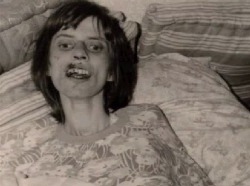 Anneliese Michel was a German Catholic woman who was said to be possessed by demons. Her family and priest tried to get her to undergo an exorcism but it didn&rsquo;t appear to work. She died. An autopsy revealed that she died from starvation and dehydrat