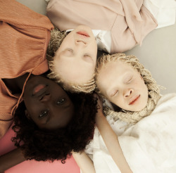 wetheurban:  Flores Raras, Vinicius Terranova In “Flores Raras,” Brazilian photographer Vinicius Terranova photographs Lara and Mara, black twins with albanism, and their older sister Sheila, who has a significantly darker skin tone. The stark contrast