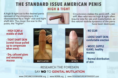 Normal Circumcised Penis 10
