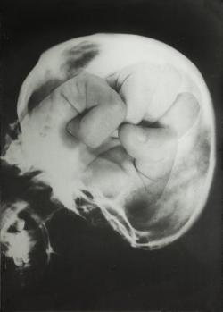vivipiuomeno1:  Ketty La Rocca, ‘Craniologia’, 1973
