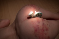 defiantly-yourss:  wtf-mcb-123:  defiantly-yourss:  Birthday cake.  (Thanks @vanerotica for lubing up the candles and not calling me crazy for proposing this idea)  What’s the red irritation on your sexy ass? Candle wax? Allergies?  Bruises from being