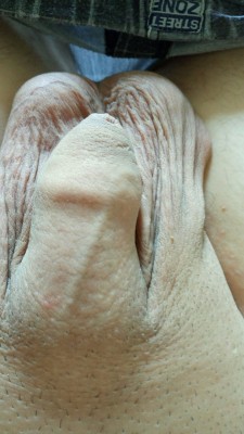 uncut2cut:  jj220011:  Just showing off my big testicles! #bigballs #smallcock #smooth  Circumcision would vastly improve the looks and quality of that cock.  I agree high and tight