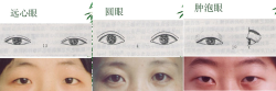 exrpan:  mirrepp:  14 Different kinds of asian eye shapes.  I’m so glad someone put this together. ASIANS DO NOT ALL HAVE THE SAME EYES. 