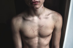 coltre:  I took this picture today; the dots, the marks on the skin. The bruises, the scratches. It makes me think about how beautiful the human skin is, and all the pain it can endure. All the wounds it can quickly heal, to protect our being. Over and