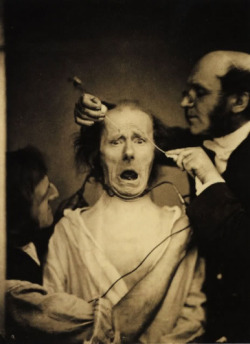 sixpenceee:  UNETHICAL EXPERIMENTS: SHOCKS FOR PICTURES In 1862, French neurologist Guillaume Duchenne wanted to test the popular theory (at the time) that the face was directly linked to the soul. He had already done some work applying electric shocks