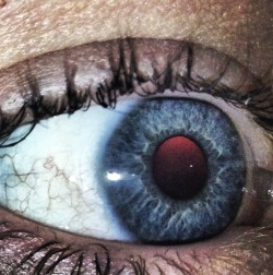 Took a picture of my eye and it went like this