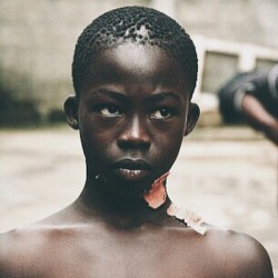 kemetic-dreams:  amysall:Mutilated bodies of children have turned up recently in Ivory Coast, as a “wave” of child ritual killings has been occurring. About 20 have been abducted and killed, and some like Souleymane pictured, narrowly escaped with